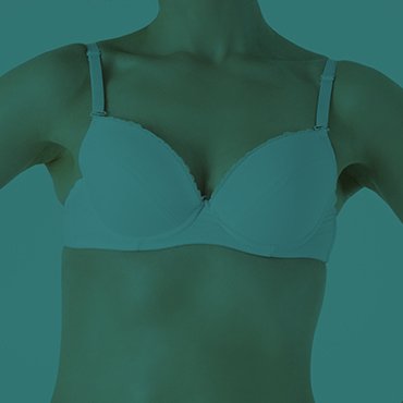 mamoplastia-redudora-explante-vila-mariana